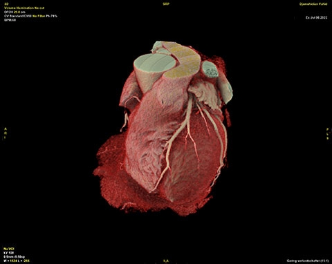 Der CardioGraphe™ liefert detaillierte 3D-Bilder des Herzens