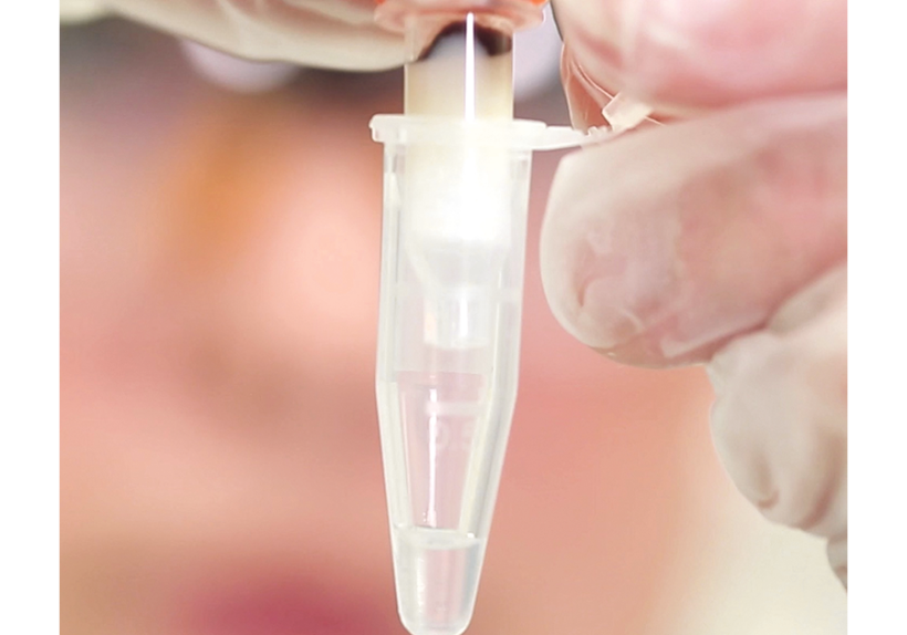 Isolation von DNA aus Blut in nur einem Schritt. Isolation von DNA aus Blut in nur einem Schritt.