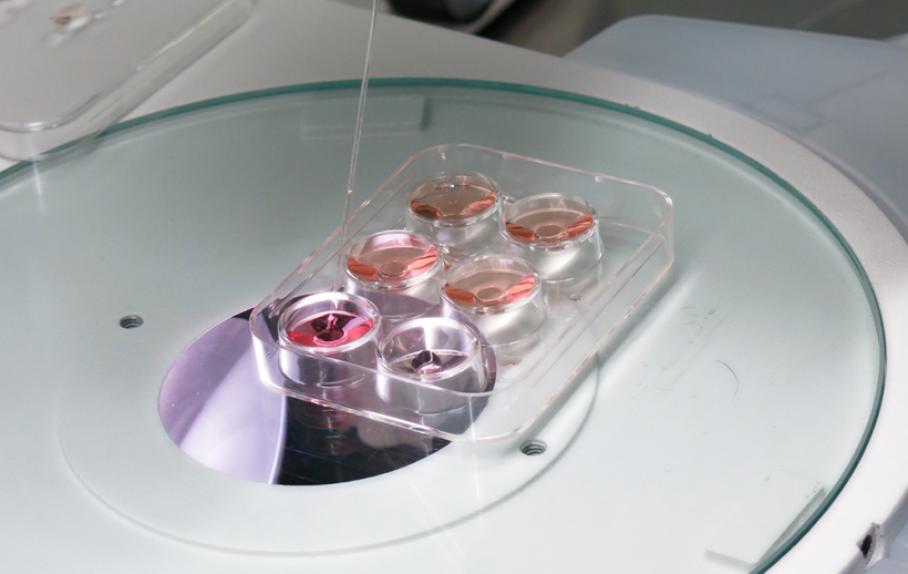 IVF.Spain