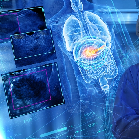Die neue KI-Software hat das Potenzial, die Diagnostik von Pankreas-Erkrankungen zu revolutionieren.  Copyright: Medi-Globe Group